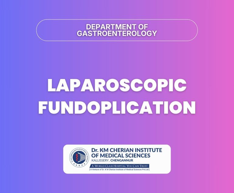 Laparoscopic Fundoplication